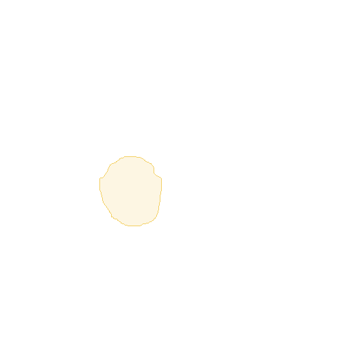 与原图严格对齐的原始专家分割